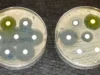 The antibiotic resistance crisis: why the world is quietly running out of treatments