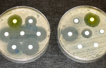 The antibiotic resistance crisis: why the world is quietly running out of treatments