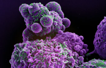The science of infectious disease: why pandemics follow predictable patterns