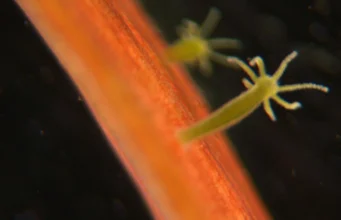 The science of aging: why we age, why some species barely do, and whether the process is inevitable